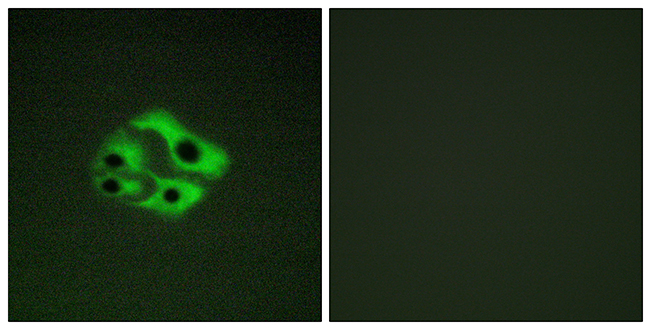 Rabbit Anti-Human BAD (Phospho-Ser134) polyclonal antibody (CABT-L3287)