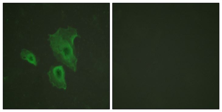 Rabbit Anti-Human BCL2 (Phospho-Thr69) polyclonal antibody (CABT-L3299)