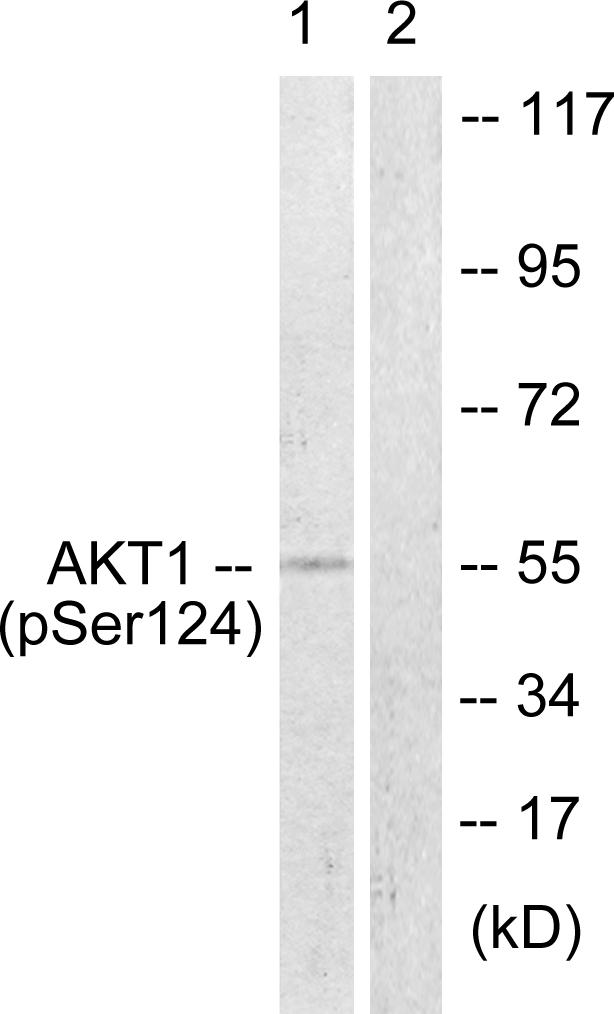 Rabbit Anti-Human AKT1 (Phospho-Ser124) polyclonal antibody (CABT-L3242)