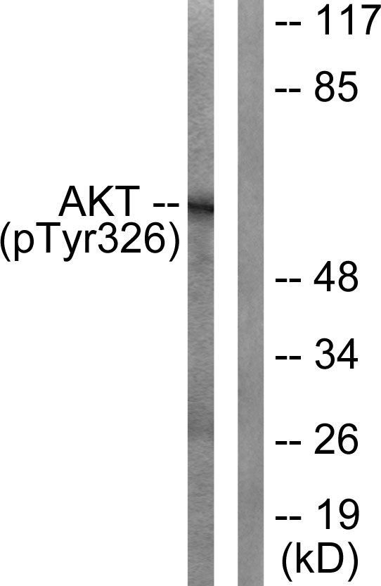 Rabbit Anti-Human AKT1 (Phospho-Tyr326) polyclonal antibody (CABT-L3243)