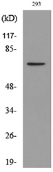 Rabbit Anti-Human ARNTL (Acetyl-Lys538) polyclonal antibody (CABT-L3266)