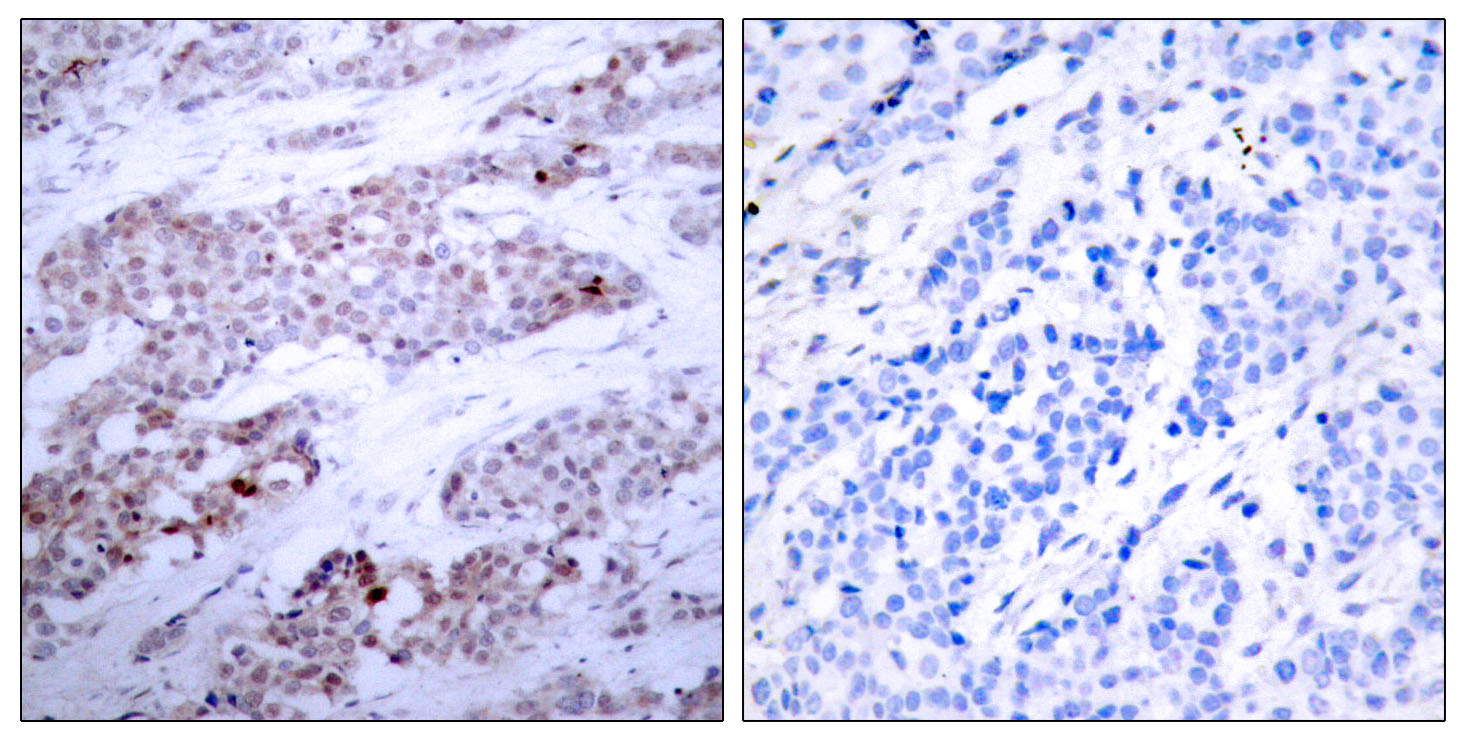 Rabbit Anti-Human ATF4 (Phospho-Ser245) polyclonal antibody (CABT-L3271)