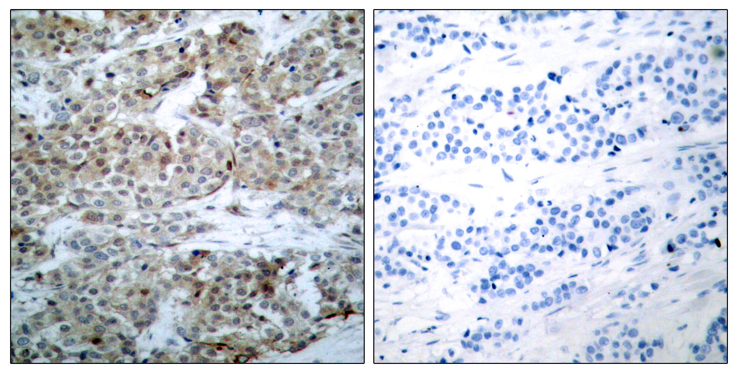 Rabbit Anti-Human BAD (Phospho-Ser112) polyclonal antibody (CABT-L3289)