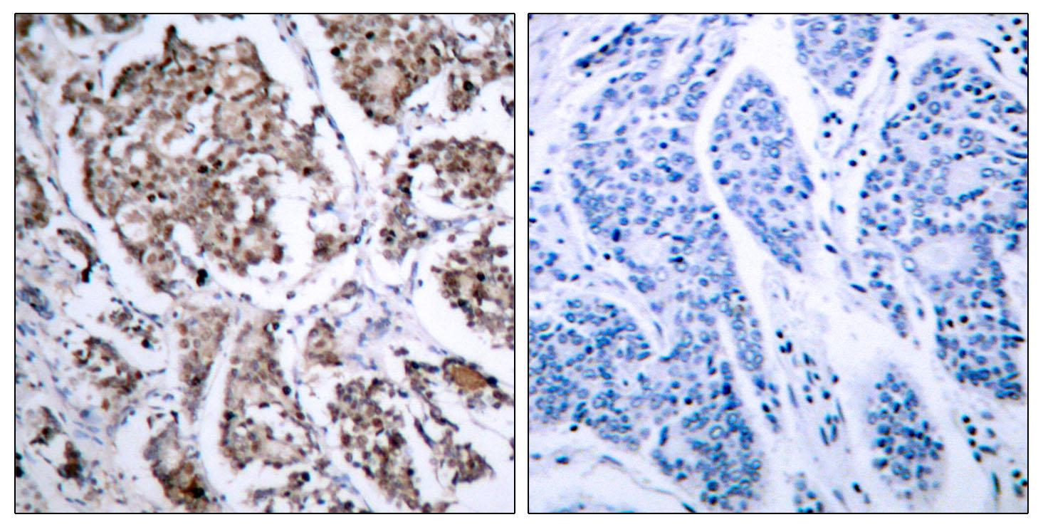 Rabbit Anti-Human BAD (Phospho-Ser155) polyclonal antibody (CABT-L3291)