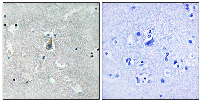 Rabbit Anti-Human BAX (Phospho-Ser184) polyclonal antibody (CABT-L3292)