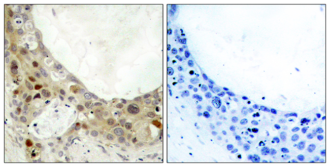 Rabbit Anti-Human BCL2 (Phospho-Ser70) polyclonal antibody (CABT-L3297)