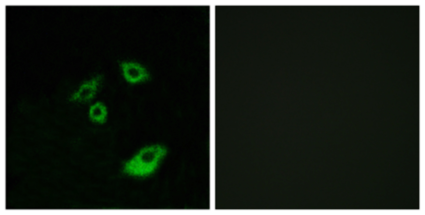 Rabbit Anti-Human BCL2 (Phospho-Thr56) polyclonal antibody (CABT-L3298)