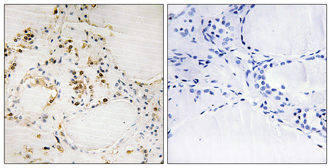 Rabbit Anti-Human BCL2 (Phospho-Ser87) polyclonal antibody (CABT-L3300)