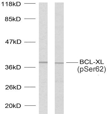 Rabbit Anti-Human BCL2L1 (Phospho-Ser62) polyclonal antibody (CABT-L3302)