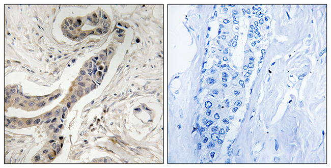 Rabbit Anti-Human BCL2L1 (Phospho-Thr115) polyclonal antibody (CABT-L3303)