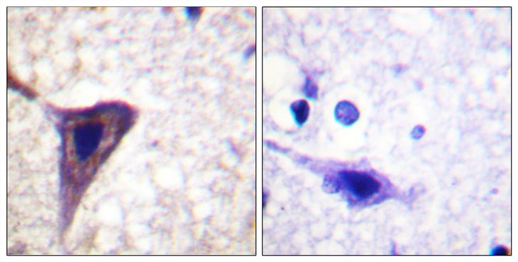 Rabbit Anti-Human BID (Phospho-Ser78) polyclonal antibody (CABT-L3309)