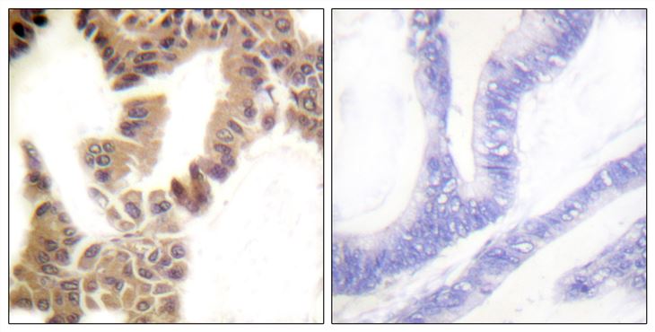 Rabbit Anti-Human CASP2 (Phospho-Ser157) polyclonal antibody (CABT-L3342)