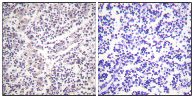 Rabbit Anti-Human CASP3 (Phospho-Ser150) polyclonal antibody (CABT-L3345)