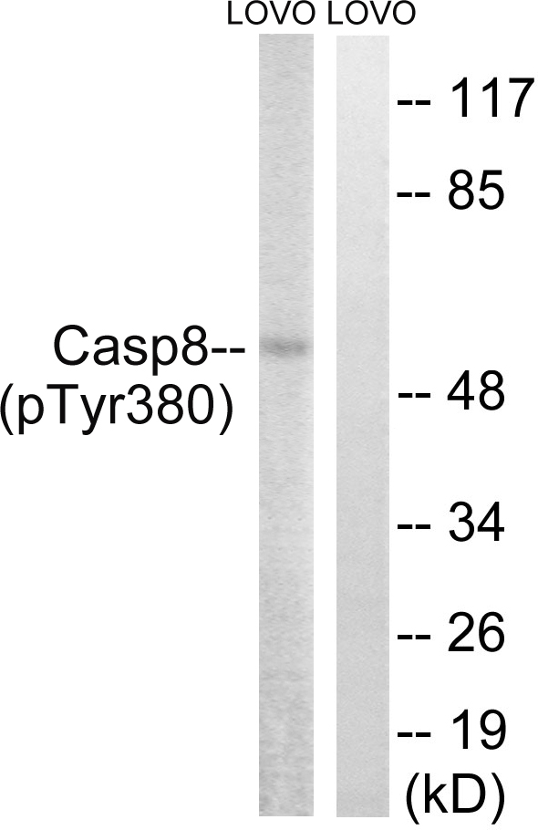 Rabbit Anti-Human CASP8 (Phospho-Tyr380) polyclonal antibody (CABT-L3355)