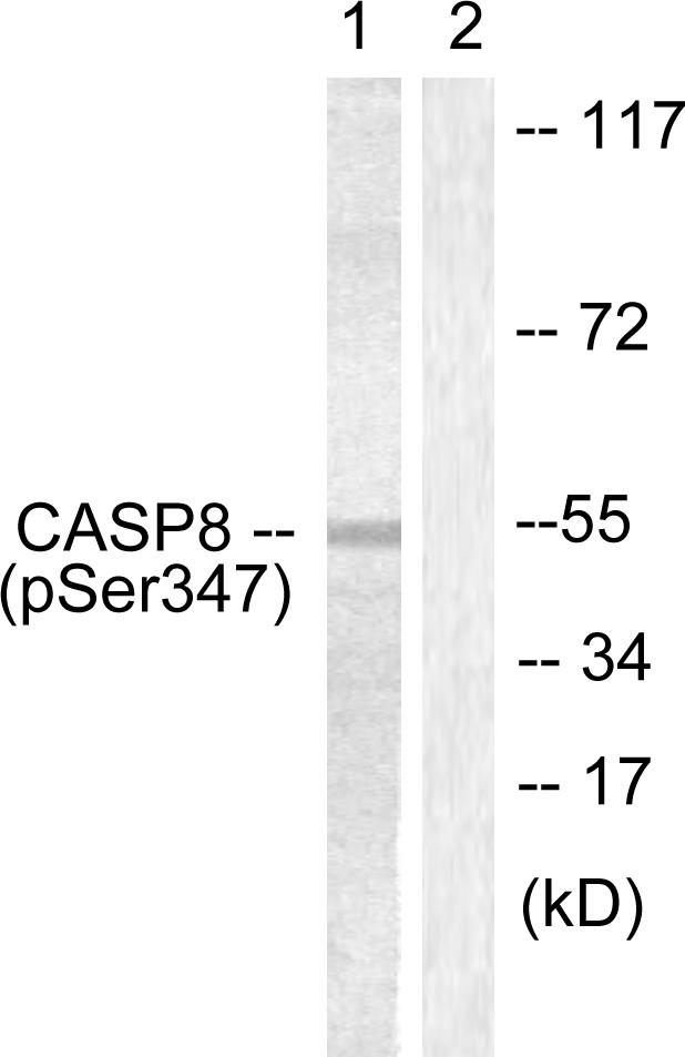 Rabbit Anti-Human CASP8 (Phospho-Ser347) polyclonal antibody (CABT-L3356)