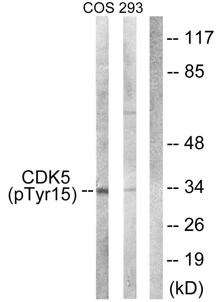 Rabbit Anti-Human CDK5 (Phospho-Tyr15) polyclonal antibody (CABT-L3406)