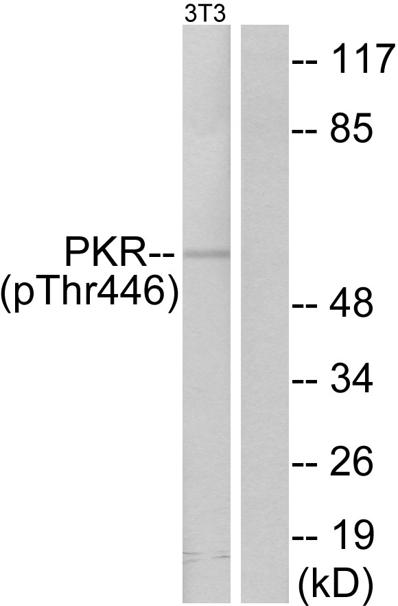 Rabbit Anti-Human EIF2AK2 (Phospho-Thr446) polyclonal antibody (CABT-L3520)