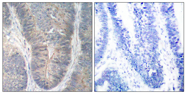 Rabbit Anti-Human EIF2AK2 (Phospho-Thr451) polyclonal antibody (CABT-L3521)