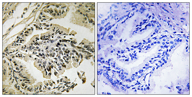 Rabbit Anti-Human EIF2AK3 (Phospho-Thr981) polyclonal antibody (CABT-L3522)