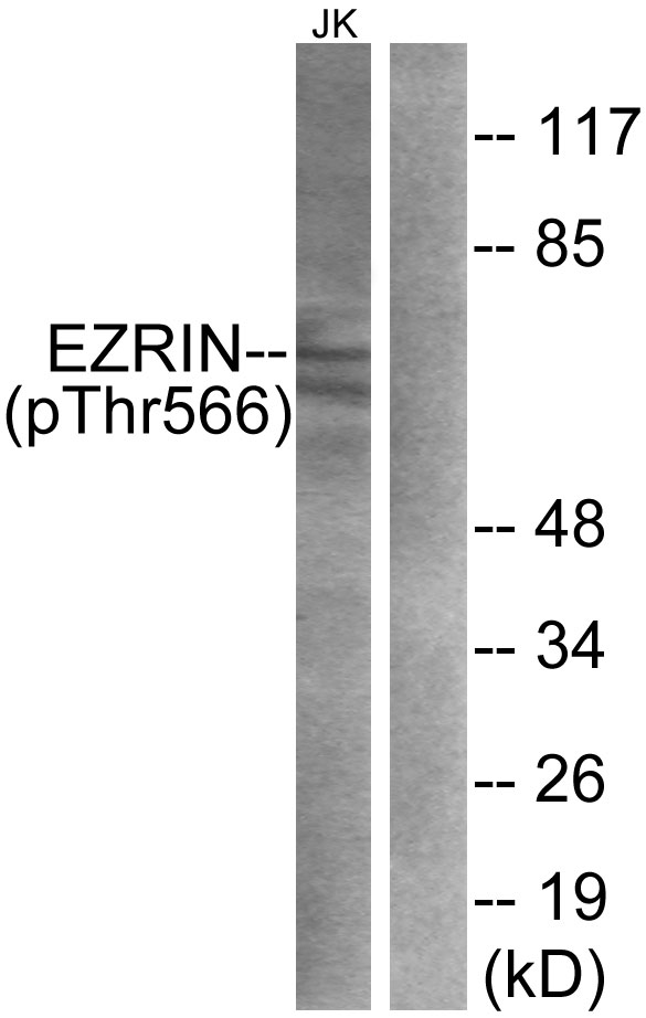 Rabbit Anti-Human EZR (Phospho-Thr566) polyclonal antibody (CABT-L3556)