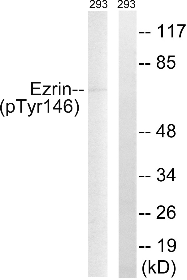 Rabbit Anti-Human EZR (Phospho-Tyr146) polyclonal antibody (CABT-L3557)