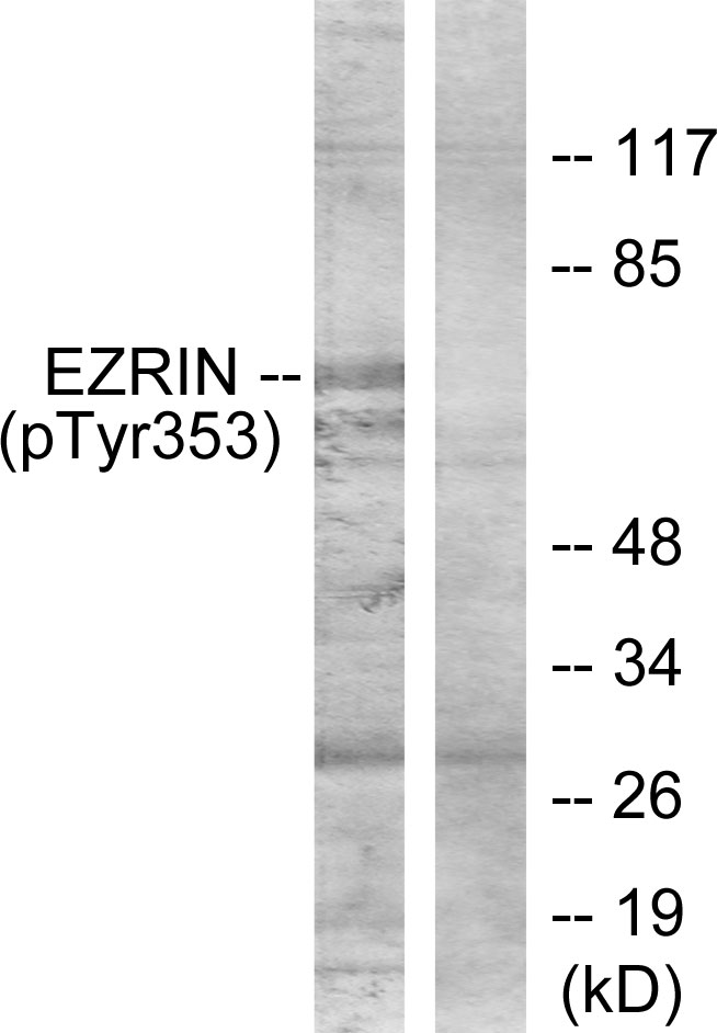 Rabbit Anti-Human EZR (Phospho-Tyr353) polyclonal antibody (CABT-L3558)