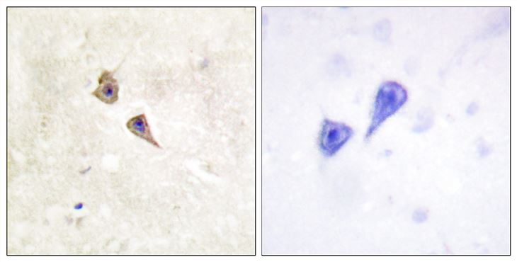 Rabbit Anti-Human IFNAR1 (Phospho-Tyr466) polyclonal antibody (CABT-L3680)