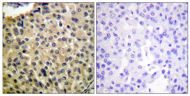 Rabbit Anti-Human KIT (Phospho-Tyr703) polyclonal antibody (CABT-L3768)