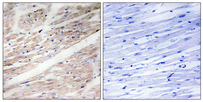 Rabbit Anti-Human KIT (Phospho-Tyr936) polyclonal antibody (CABT-L3769)