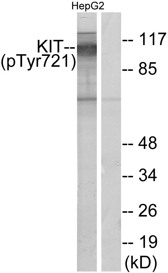 Rabbit Anti-Human KIT (Phospho-Tyr721) polyclonal antibody (CABT-L3770)