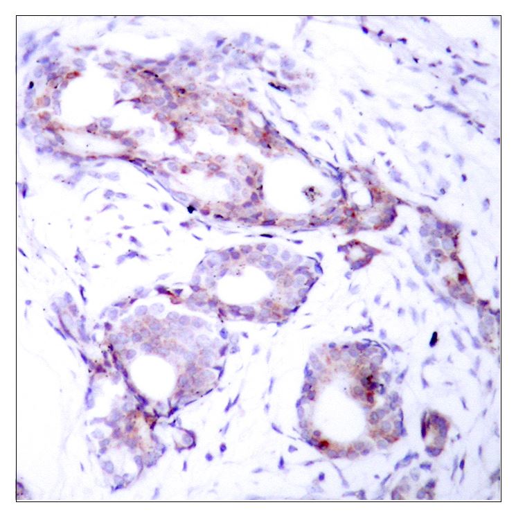 Rabbit Anti-Human MYC (Phospho-Ser373) polyclonal antibody (CABT-L3889)