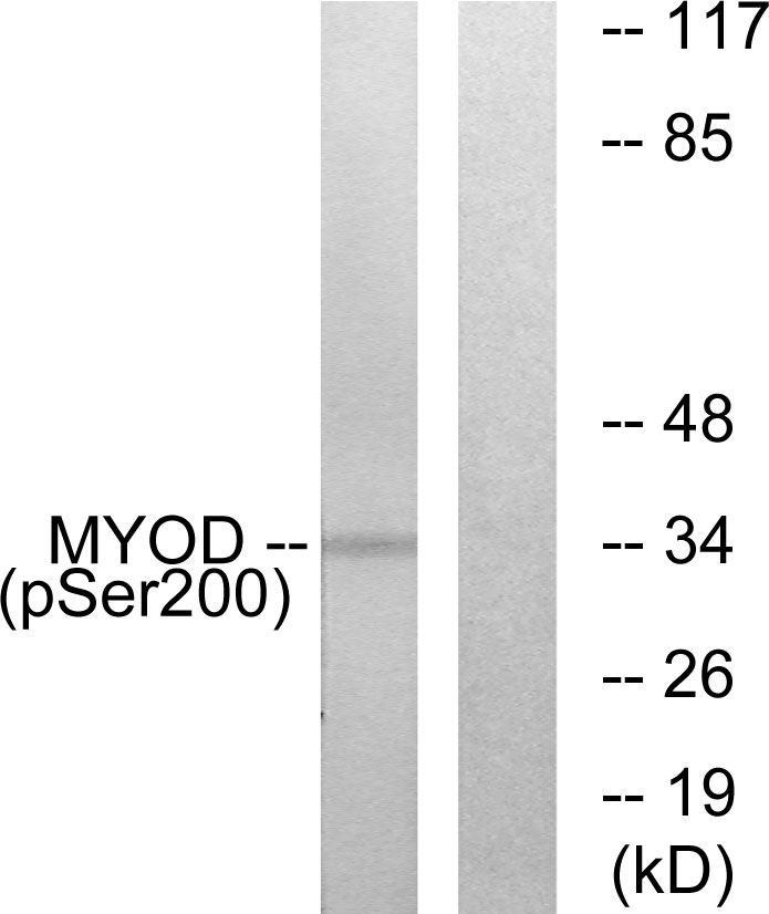 Rabbit Anti-Human MYOD1 (Phospho-Ser200) polyclonal antibody (CABT-L3893)