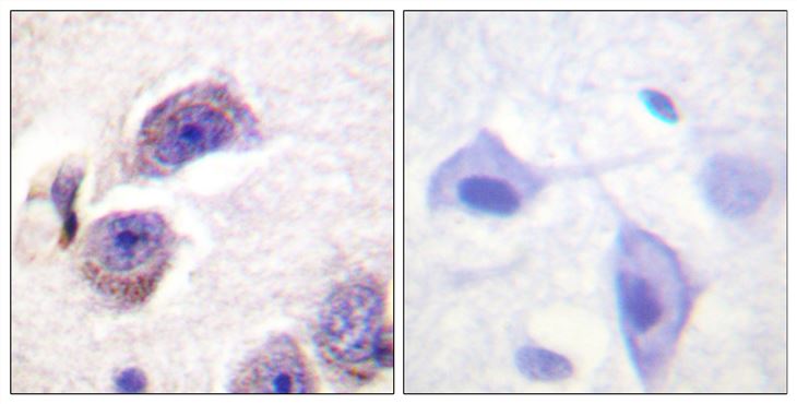 Rabbit Anti-Human PTK2 (Phospho-Tyr407) polyclonal antibody (CABT-L4020)