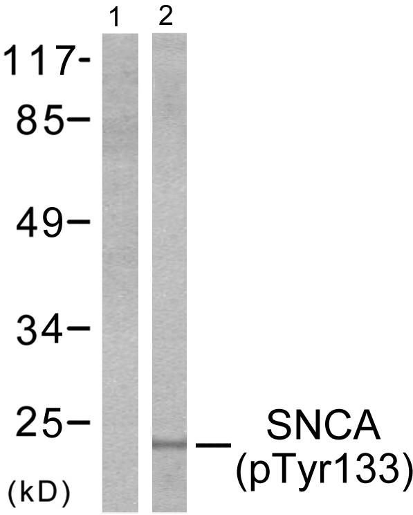 Rabbit Anti-Human SNCA (Phospho-Tyr133) polyclonal antibody (CABT-L4102)