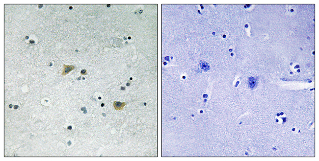 Rabbit Anti-Human SRC (Phospho-Ser75) polyclonal antibody (CABT-L4108)