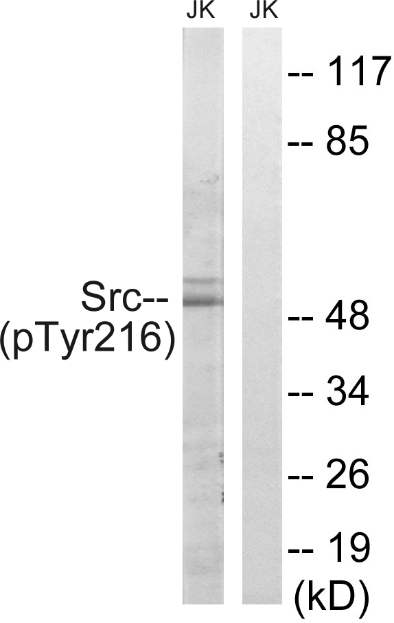 Rabbit Anti-Human SRC (Phospho-Tyr216) polyclonal antibody (CABT-L4109)