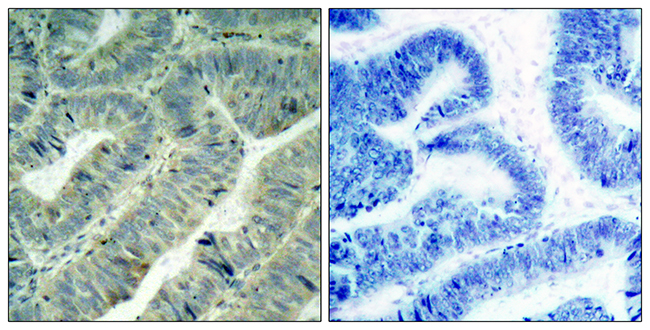 Rabbit Anti-Human SRC (Phospho-Tyr418) polyclonal antibody (CABT-L4110)