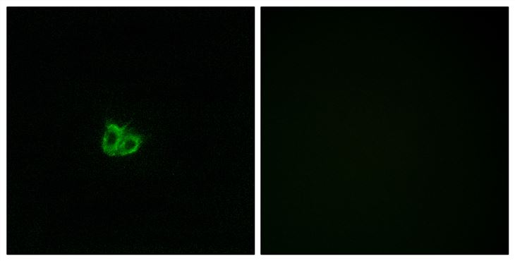 Rabbit Anti-Human STMN1 (Phospho-Ser15) polyclonal antibody (CABT-L4130)