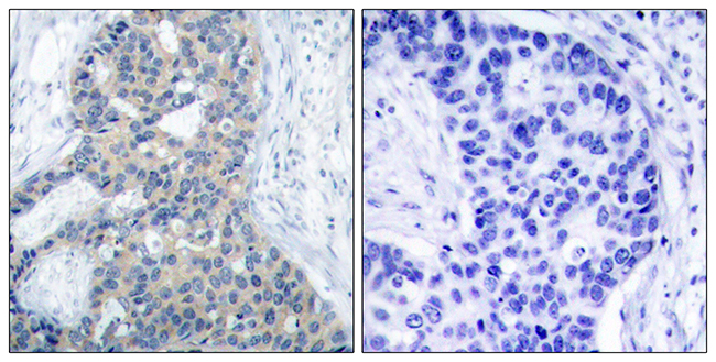 Rabbit Anti-Human STMN1 (Phospho-Ser37) polyclonal antibody (CABT-L4132)