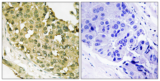 Rabbit Anti-Human STMN1 (Phospho-Ser62) polyclonal antibody (CABT-L4133)