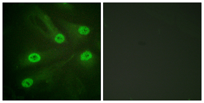 Rabbit Anti-Human TP53 (Acetyl-Lys386) polyclonal antibody (CABT-L4164)