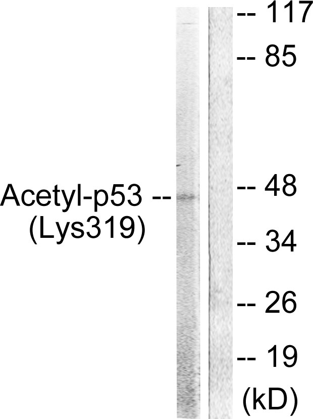 Rabbit Anti-Human TP53 (Acetyl-Lys319) polyclonal antibody (CABT-L4165)