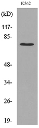 Rabbit Anti-Human TP73 (Acetyl-Lys321) polyclonal antibody (CABT-L4182)