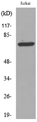 Rabbit Anti-Human TP73 (Acetyl-Lys327) polyclonal antibody (CABT-L4183)