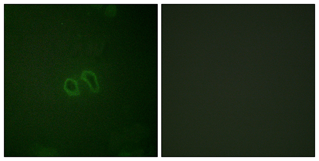 Rabbit Anti-Human VINC (Phospho-Tyr821) polyclonal antibody (CABT-L4198)