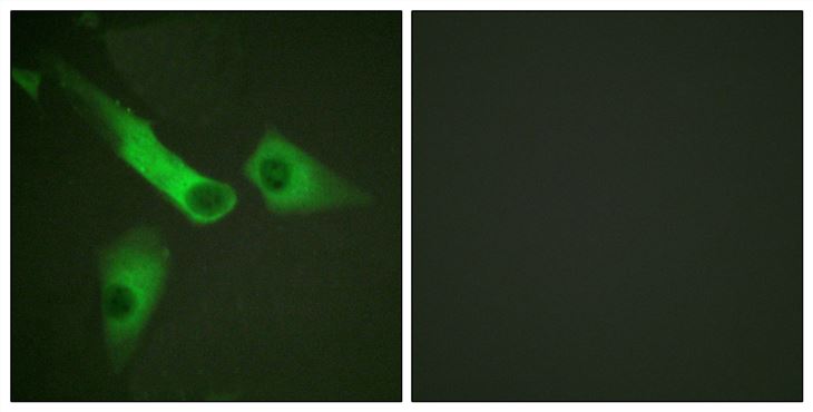 Rabbit Anti-Human CASP9 (Phospho-Tyr153) polyclonal antibody (CABT-L3361)