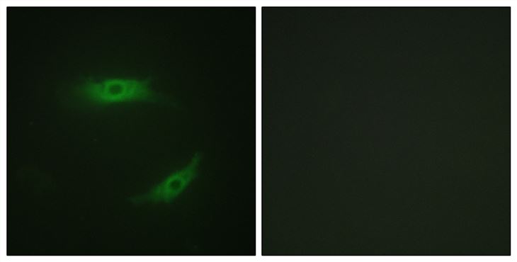 Rabbit Anti-Human CD4 (Phospho-Ser433) polyclonal antibody (CABT-L3387)