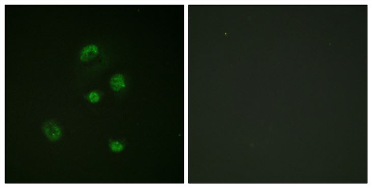 Rabbit Anti-Human DDIT3 (Phospho-Ser30) polyclonal antibody (CABT-L3487)