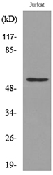 Rabbit Anti-Human TP53 (Acetyl-Lys372) polyclonal antibody (CABT-L4163)