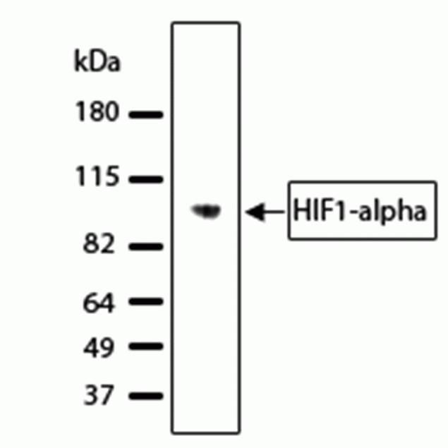 Rabbit Anti-Human HIF1A monoclonal antibody, clone 27I5M24 (DCABH-9044)